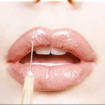 In crescita il pericoloso fenomeno delle iniezioni cosmetiche illegali