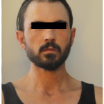 SORPRESO MENTRE SCAVALCA LA RECINZIONE DI UNO STUDIO MEDICO. ARRESTATO DALLE VOLANTI.
