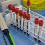 LABORATORI DI ANALISI, O POLLAI?