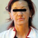 RISSA NELLA NOTTE A LECCE, UN ARRESTO