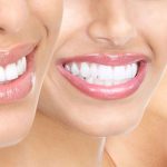 SANTA APOLLONIA, A COPERTINO UN CENTRO ODONTOIATRICO ALL’AVANGUARDIA NELLA CURA DEI DENTI